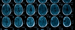 Las altas temperaturas podrían afectar a la función cerebral en preadolescentes, según un estudio del Instituto de Salud Global de Barcelona