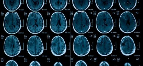 Las altas temperaturas podrían afectar a la función cerebral en preadolescentes, según un estudio del Instituto de Salud Global de Barcelona